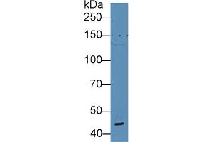 Western Blot; Sample: Human Serum; Primary Ab: 5µg/ml Rabbit Anti-Human vWA3A Antibody Second Ab: 0. (VWA3A antibody  (AA 981-1176))