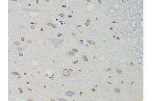 Immunohistochemistry of paraffin-embedded rat spinal cord using LMNB1 antibody (ABIN5970980) at dilution of 1/100 (40x lens). (Lamin B1 antibody)