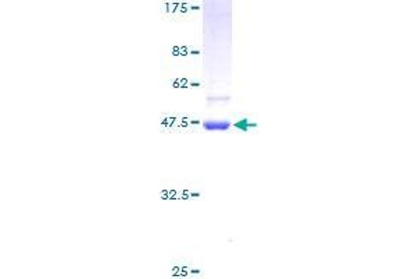 STK32A Protein (AA 1-166) (GST tag)