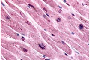 Human Heart (formalin-fixed, paraffin-embedded) stained with CHRM3 antibody ABIN213346 at 10 ug/ml followed by biotinylated goat anti-rabbit IgG secondary antibody ABIN481713, alkaline phosphatase-streptavidin and chromogen. (CHRM3 antibody  (Cytoplasmic Domain))