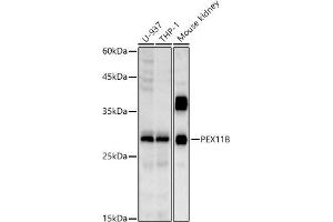 Western blot analysis of extracts of various cell lines, using PEX11B antibody (ABIN7269244) at 1:1000 dilution. (PEX11B antibody)