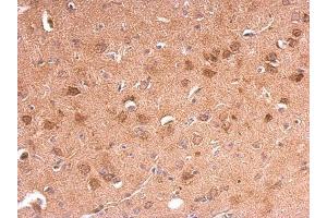 Immunohistochemistry (IHC) image for anti-Adiponectin Receptor 1 (ADIPOR1) (C-Term) antibody (ABIN2855945)