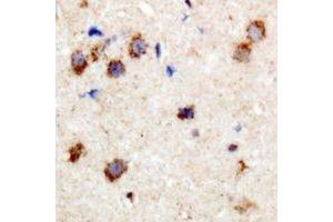 Immunohistochemical analysis of CPI17 (pT38) staining in human brain formalin fixed paraffin embedded tissue section. (CPI-17 antibody  (N-Term, pSer38))