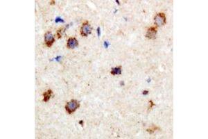 Immunohistochemical analysis of CPI17 (pT38) staining in human brain formalin fixed paraffin embedded tissue section.