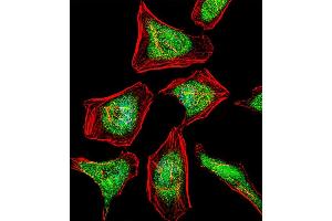 Fluorescent confocal image of Hela cell stained with ATF7 Antibody (N-term) (ABIN1881079 and ABIN2842518). (ATF7 antibody  (N-Term))