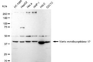 Western blotting analysis using Matrix metallopeptidase 12 antibody (ABIN7799339).