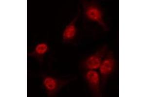 ABIN6267539 staining 293 by IF/ICC. (SOX9 antibody  (pSer181))