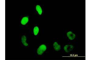 Immunofluorescence of purified MaxPab antibody to WHSC2 on HeLa cell. (WHSC2 antibody  (AA 1-528))