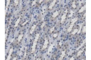 DAB staining on IHC-P; Samples: Mouse Kidney Tissue (UMPS antibody  (AA 311-481))