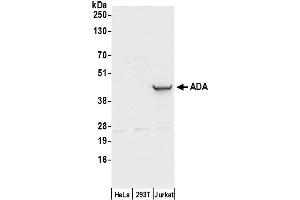 Western Blotting (WB) image for anti-Adenosine Deaminase (ADA) (AA 100-150) antibody (ABIN7449944)