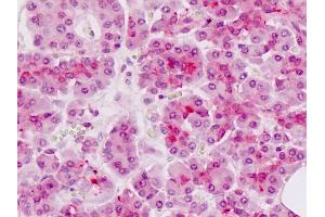 Human, Pancreas: Formalin-Fixed Paraffin-Embedded (FFPE)