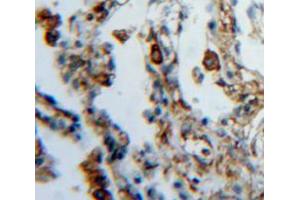 Used in DAB staining on fromalin fixed paraffin-embedded lung tissue (FES antibody  (AA 510-770))