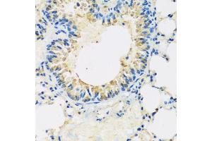 Immunohistochemistry of paraffin-embedded mouse lung using ABCF2 antibody (ABIN5972445) at dilution of 1/100 (40x lens).