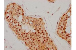 Immunohistochemistry (IHC) image for anti-Ataxia Telangiectasia Mutated (ATM) antibody (ABIN7127350)