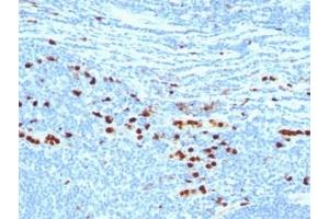 Formalin-fixed, paraffin-embedded human tonsil stained with MRP8 + MPR14 protein antibody (MAC387)