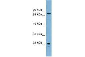 Image no. 1 for anti-Membrane Protein, Palmitoylated 5 (MAGUK P55 Subfamily Member 5) (MPP5) (AA 575-624) antibody (ABIN6742119) (MPP5 antibody  (AA 575-624))