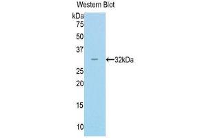 Western Blotting (WB) image for anti-Myosin (AA 1069-1331) antibody (ABIN1859923) (Myosin antibody  (AA 1069-1331))