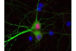 Indirect immunostaining of PFA fixed rat hippocampus neurons with anti-Tbr 1 (dilution 1 : 500; red) and mouse anti-MAP 2 (cat. (TBR1 antibody)