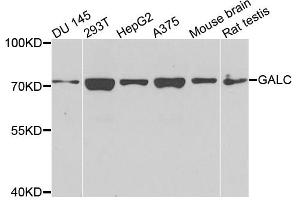 Western blot analysis of extracts of various cell lines, using GALC antibody (ABIN4903732) at 1:1000 dilution. (GALC antibody)