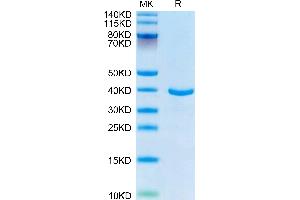 Human ANXA1 on Tris-Bis PAGE under reduced condition. (Annexin a1 Protein (AA 1-346) (His tag))