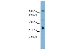 WB Suggested Anti-MAK10  Antibody Titration: 0. (MAK10/NAA35 antibody  (N-Term))