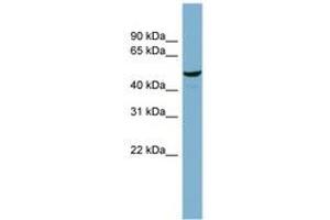 Image no. 1 for anti-Chromosome 22 Open Reading Frame 28 (C22orf28) (AA 359-408) antibody (ABIN6741853)