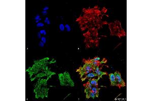 Immunocytochemistry/Immunofluorescence analysis using Mouse Anti-Alpha B Crystallin Monoclonal Antibody, Clone 3A10. (CRYAB antibody  (FITC))