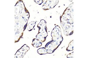Immunohistochemistry of paraffin-embedded human placenta using HB-EGF antibody (ABIN7267617) at dilution of 1:100 (40x lens). (HBEGF antibody  (AA 20-160))