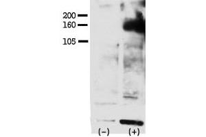 Image no. 1 for anti-V-Erb-A erythroblastic Leukemia Viral Oncogene Homolog 4 (Avian) (ERBB4) (pTyr1162) antibody (ABIN358139) (ERBB4 antibody  (pTyr1162))