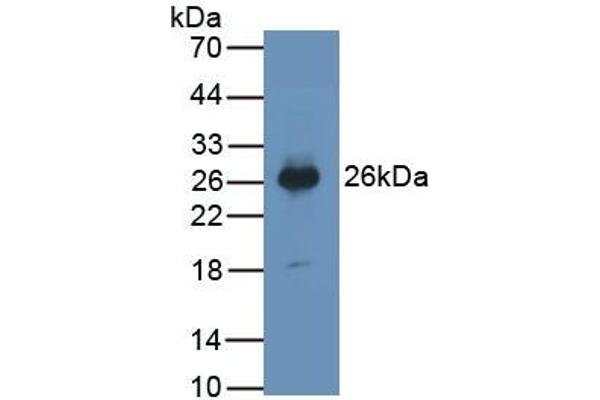 PTGDS antibody  (AA 32-190)