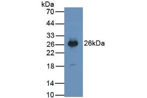 Detection of PTGDS in Human Urine using Monoclonal Antibody to Prostaglandin-H2 D-isomerase (PTGDS) (PTGDS antibody  (AA 32-190))