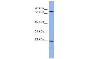 WB Suggested Anti-ZNF530 Antibody Titration:  0. (ZNF530 antibody  (N-Term))