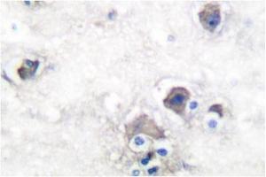 Image no. 2 for anti-Peripherin (PRPH) antibody (ABIN271783)