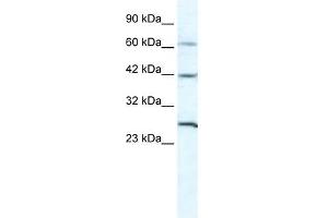 GJC1 antibody used at 5 ug/ml to detect target protein. (GJC1 antibody  (N-Term))