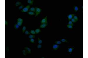 Immunofluorescence staining of Hela cells with ABIN7169724 at 1:50, counter-stained with DAPI. (SIM1 antibody  (AA 347-434))