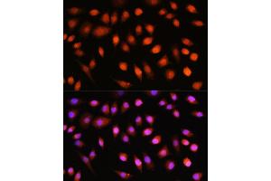 Immunofluorescence analysis of L929 cells using // antibody (ABIN7265520) at dilution of 1:100. (AKT 1/2/3 antibody)