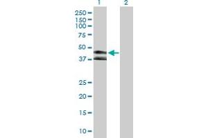 Western Blot analysis of KIR3DL1 expression in transfected 293T cell line by KIR3DL1 MaxPab polyclonal antibody. (KIR3DL1 antibody  (AA 1-382))