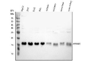 Western blot analysis of TOMM20 using anti-TOMM20 antibody (ABIN7600883).
