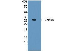 Detection of Recombinant SNAP23, Mouse using Polyclonal Antibody to Synaptosomal Associated Protein 23 kDa (SNAP23) (SNAP23 antibody  (AA 1-210))
