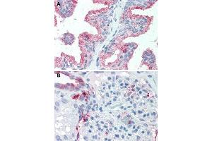 Immunohistochemical staining of human prostate (A) and human kidney (B) with SLC39A14 polyclonal antibody . (SLC39A14 antibody  (Internal Region))
