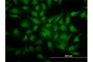 Immunofluorescence of monoclonal antibody to YBX1 on HeLa cell. (YBX1 antibody  (AA 51-139))