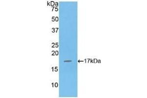 Detection of Recombinant IL16, Human using Polyclonal Antibody to Interleukin 16 (IL16) (IL16 antibody  (AA 1203-1332))