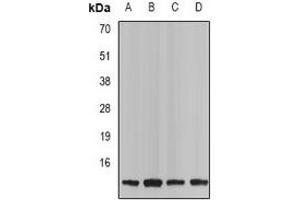 Western blot analysis of Neurokinin B expression in Jurkat (A), mouse spleen (B), rat kindney (C), rat brain (D) whole cell lysates. (Tachykinin 3 antibody)