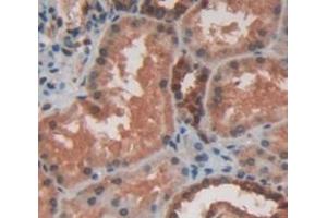 Figure. (HSPB2 antibody  (AA 12-182))