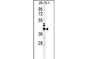 Western blot analysis of KRT35 Antibody (C-term) (ABIN651184 and ABIN2840116) in ZR-75-1 cell line lysates (35 μg/lane). (Keratin 35 antibody  (C-Term))