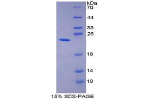 SDS-PAGE (SDS) image for Gastrokine 2 (GKN2) (AA 21-184) protein (His tag) (ABIN1170517)