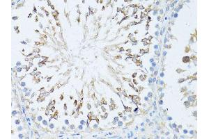 Immunohistochemistry of paraffin-embedded rat testis using TEFM antibody (ABIN5974873) at dilution of 1/100 (40x lens). (TEFM antibody)