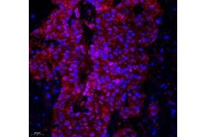 Immunofluorescence of paraffin embedded human colon using Lat (ABIN7074502) at dilution of 1: 2100 (400x lens) (LAT antibody)