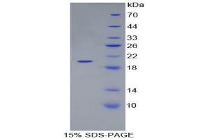SDS-PAGE (SDS) image for Laminin, beta 3 (LAMB3) (AA 1009-1148) protein (His tag) (ABIN2125595) (Laminin beta 3 Protein (AA 1009-1148) (His tag))