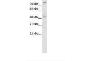 Image no. 3 for anti-Pogo Transposable Element with ZNF Domain (POGZ) (N-Term) antibody (ABIN203011) (POGZ antibody  (N-Term))